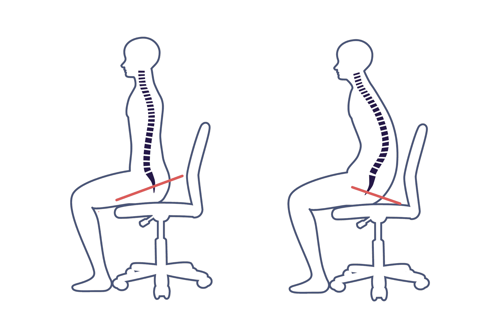 骨盤と背筋の関係