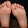 足の小指の痛み